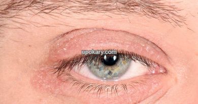 Rash or tingling in the eyelids