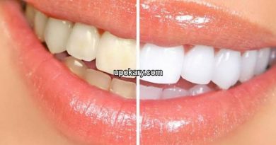 What is dental scaling